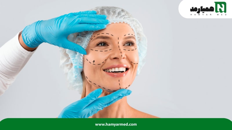 مشخص کردن خطوط لیفت روی صورت یک خانم