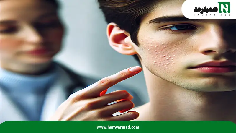 شخصی در حال نشان دادن پوست خود به پزشک برای از بین بردن جای جوش
